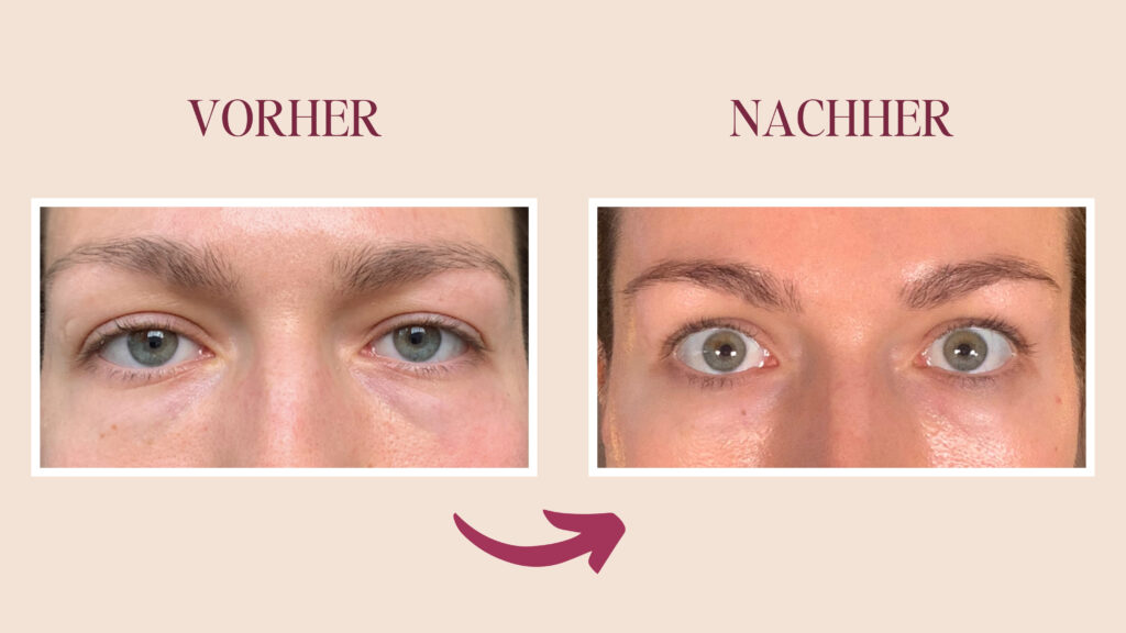 Schlupflider vs. Schlafzimmerblick