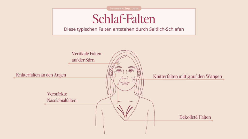 Grafik: Schlaffalten im Gesicht / Knitterfalten Wangen vom Schlafen