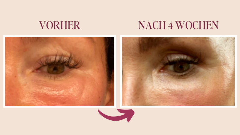 Bye-bye Schwellungen: Wie Lymphdrainage im Gesicht deine Haut zum Strahlen bringt