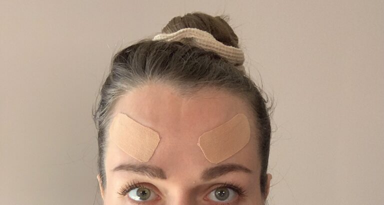 Face Taping: Was bringt das Beauty Tape bei Falten im Gesicht?