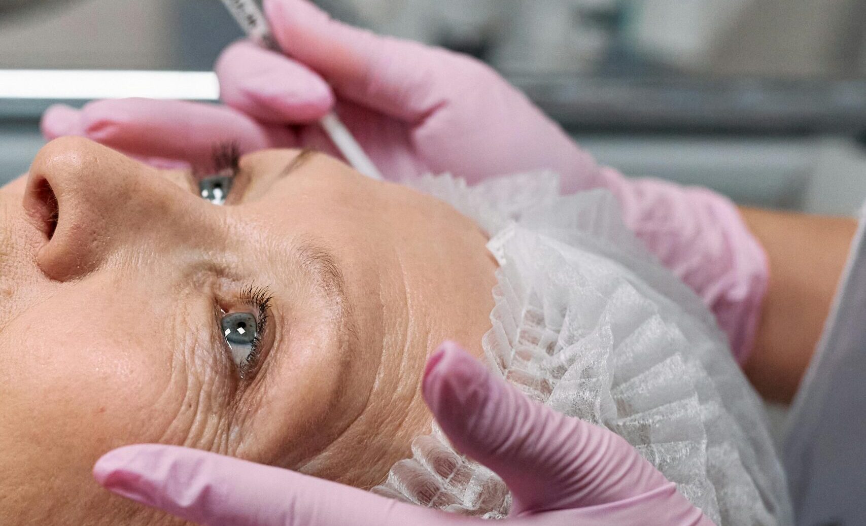 Nebenwirkungen Botox: Warum ich mir nie Botox spritzen lassen würde