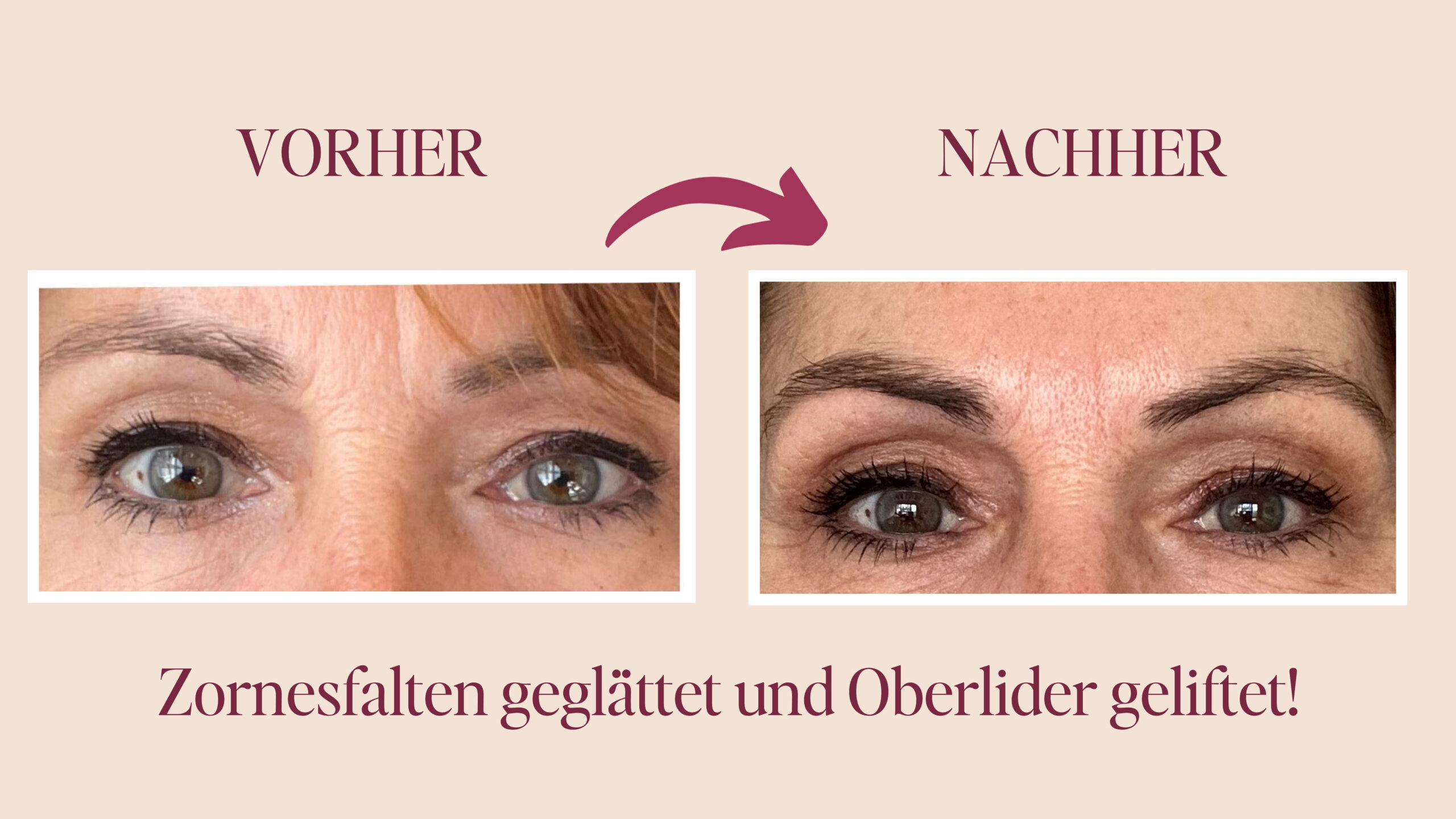 Gesichtsyoga mit 60 Vorher Nachher